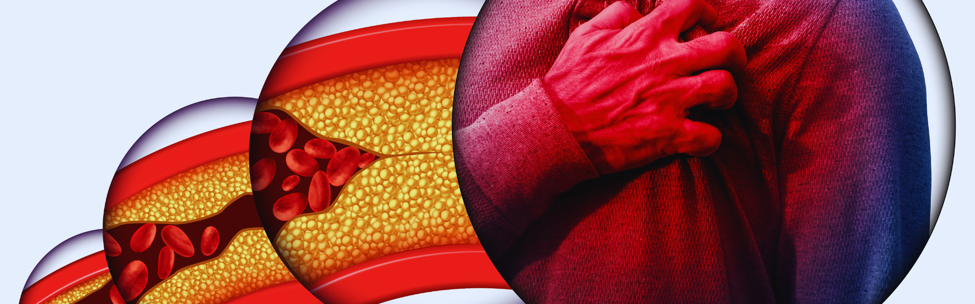 Million-dollar Research Grant to Combat Chronic Diseases 