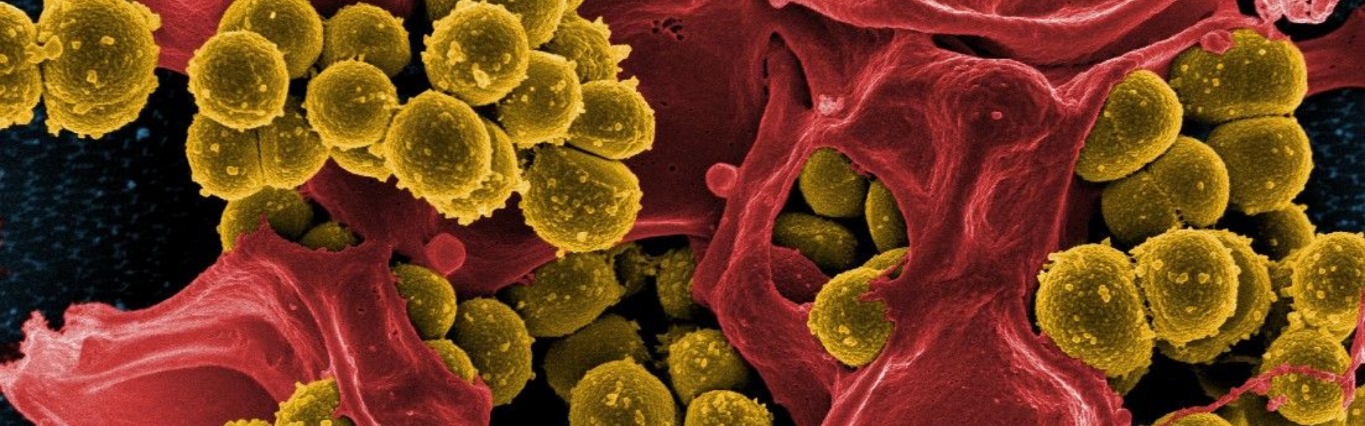 Probe into MRSA Spread and Reinfection in Barbados